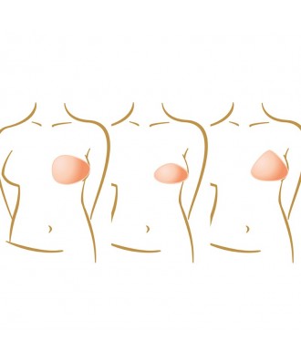 Prótesis de mama parciales - Ref: Balance